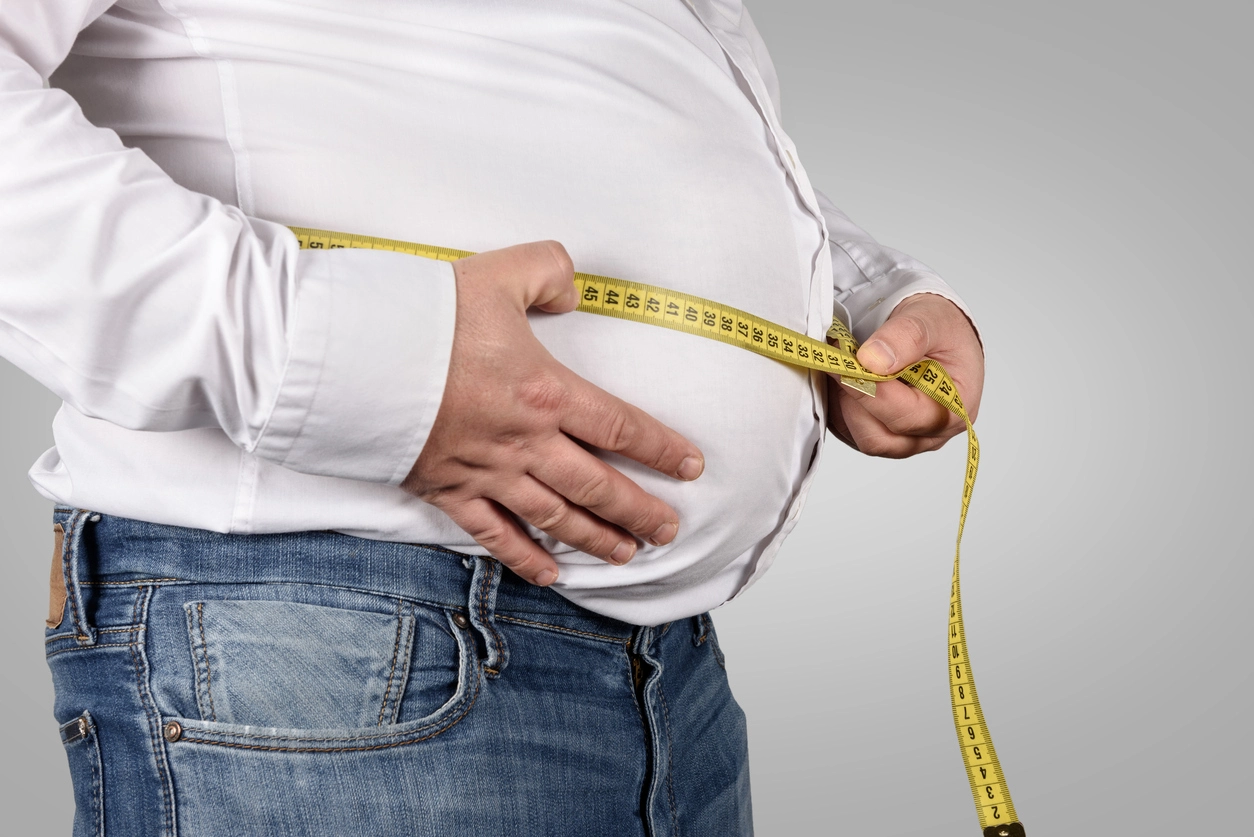 Penyebab Obesitas di Indonesia