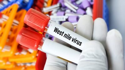 West Nile Virus Israel